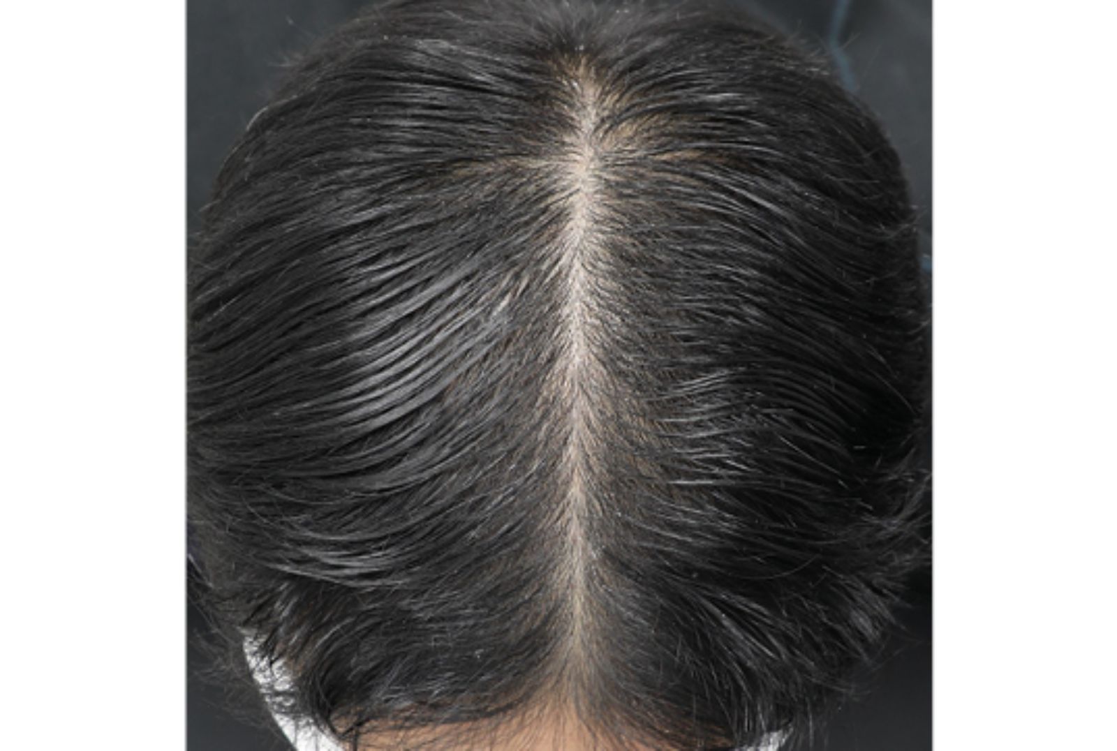 HP_density-of-hair_D0_258x173px_.jpg