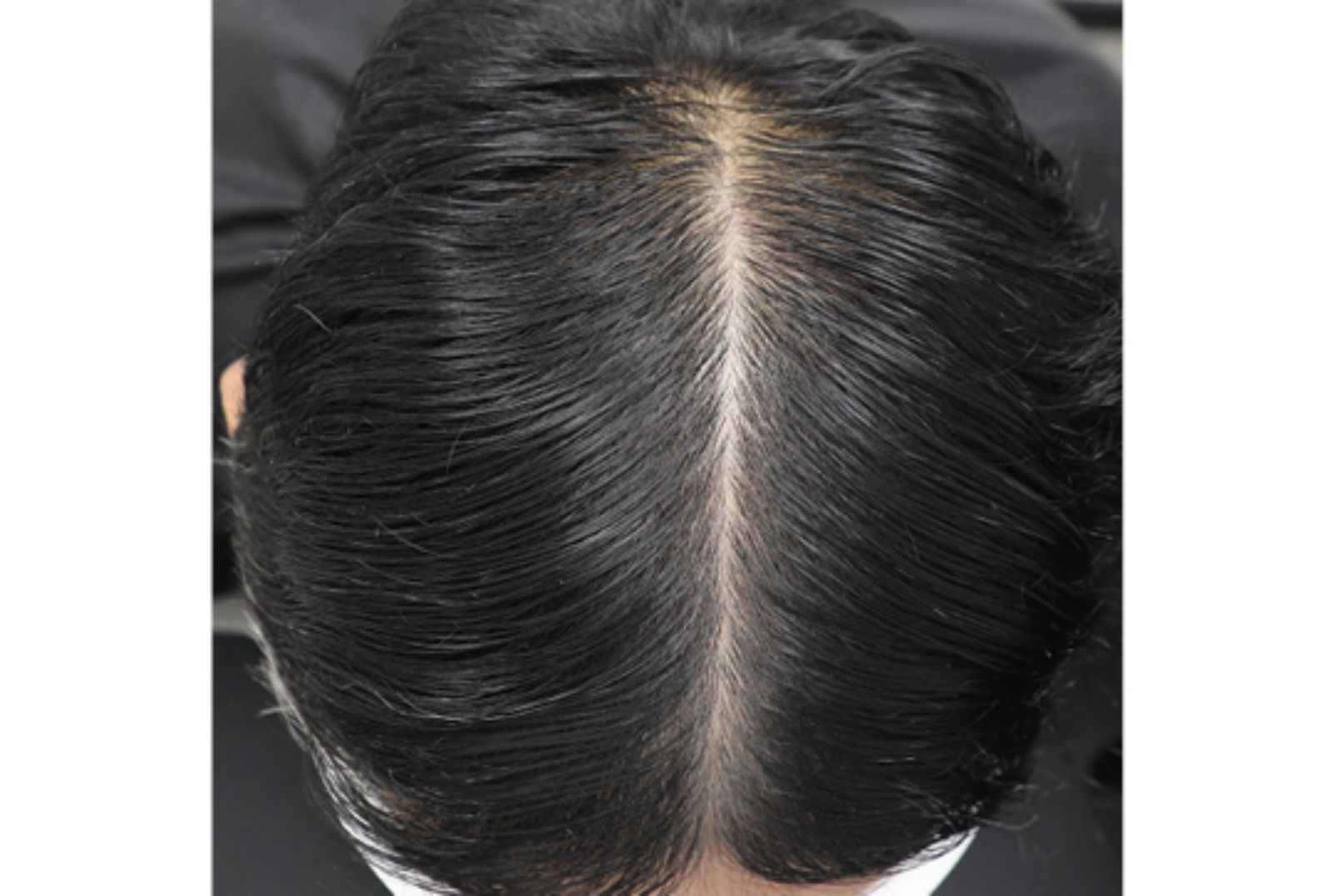 HP_density-of-hair_D180_258x173px.jpg